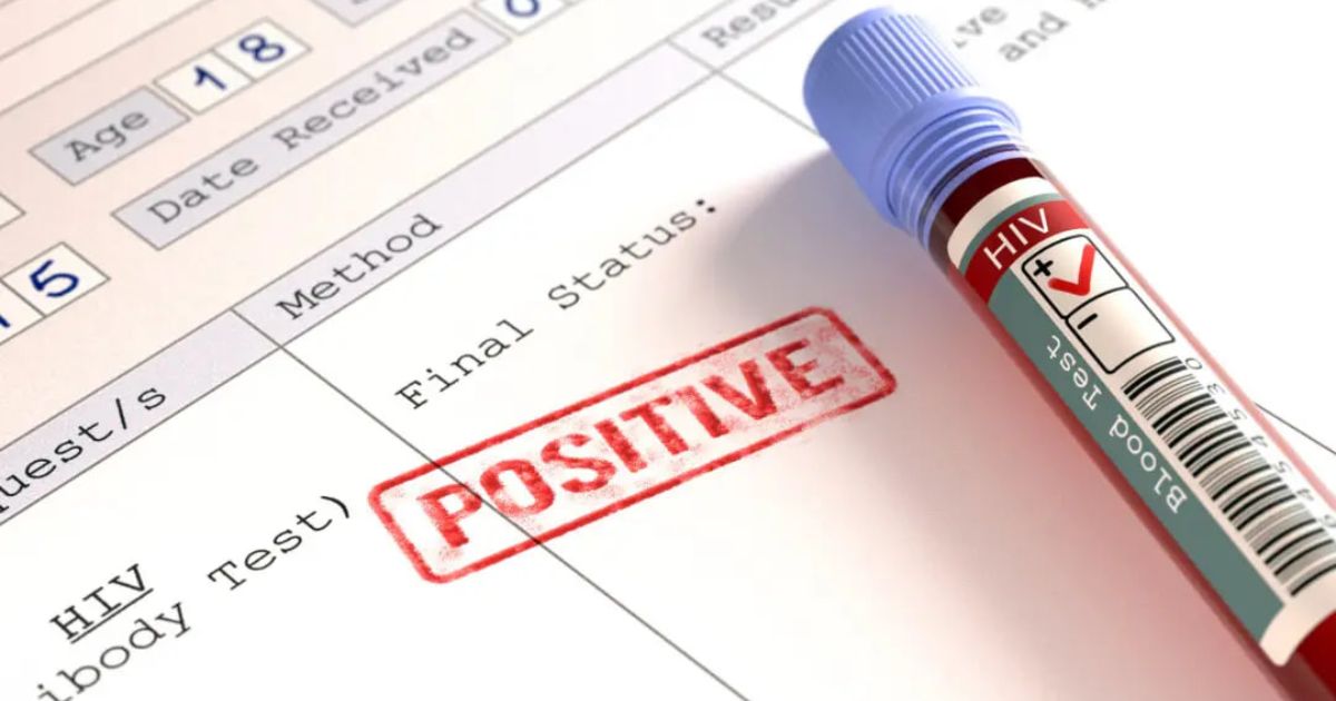 False Positive HIV